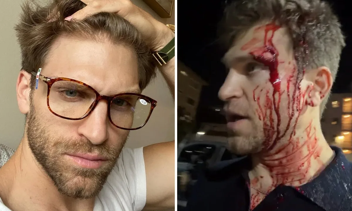 Imagens mostram ataque a Keegan Allen durante roubo de relógio