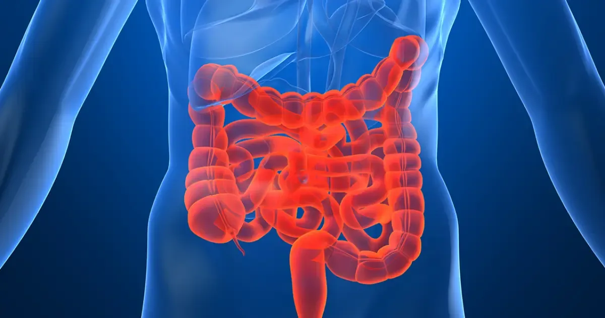 São Paulo lidera prevalência de doenças inflamatórias intestinais no país