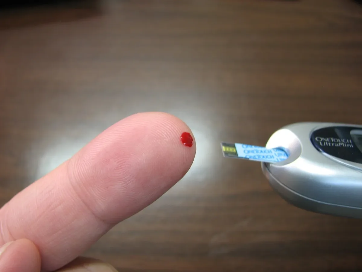 Curativo brasileiro em 3D usa descargas elétricas contra feridas do diabetes