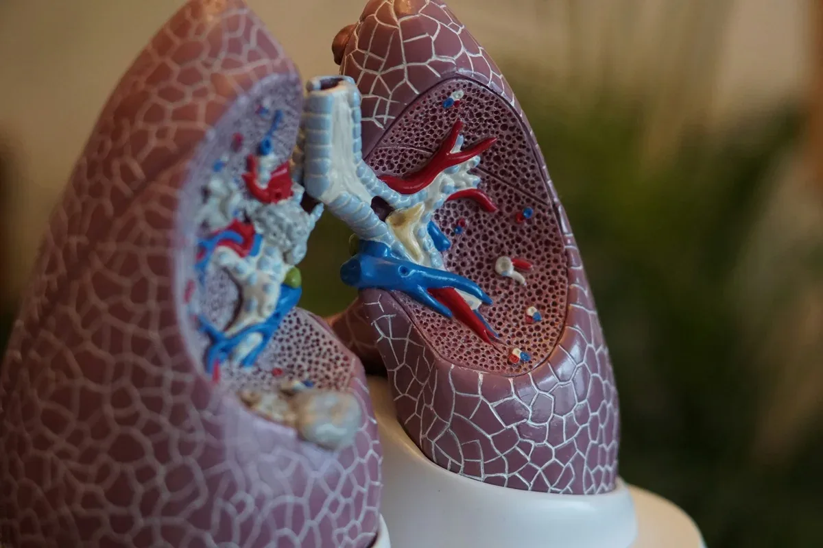 Pesquisa identifica 232 partículas de plástico em amostras pulmonares
