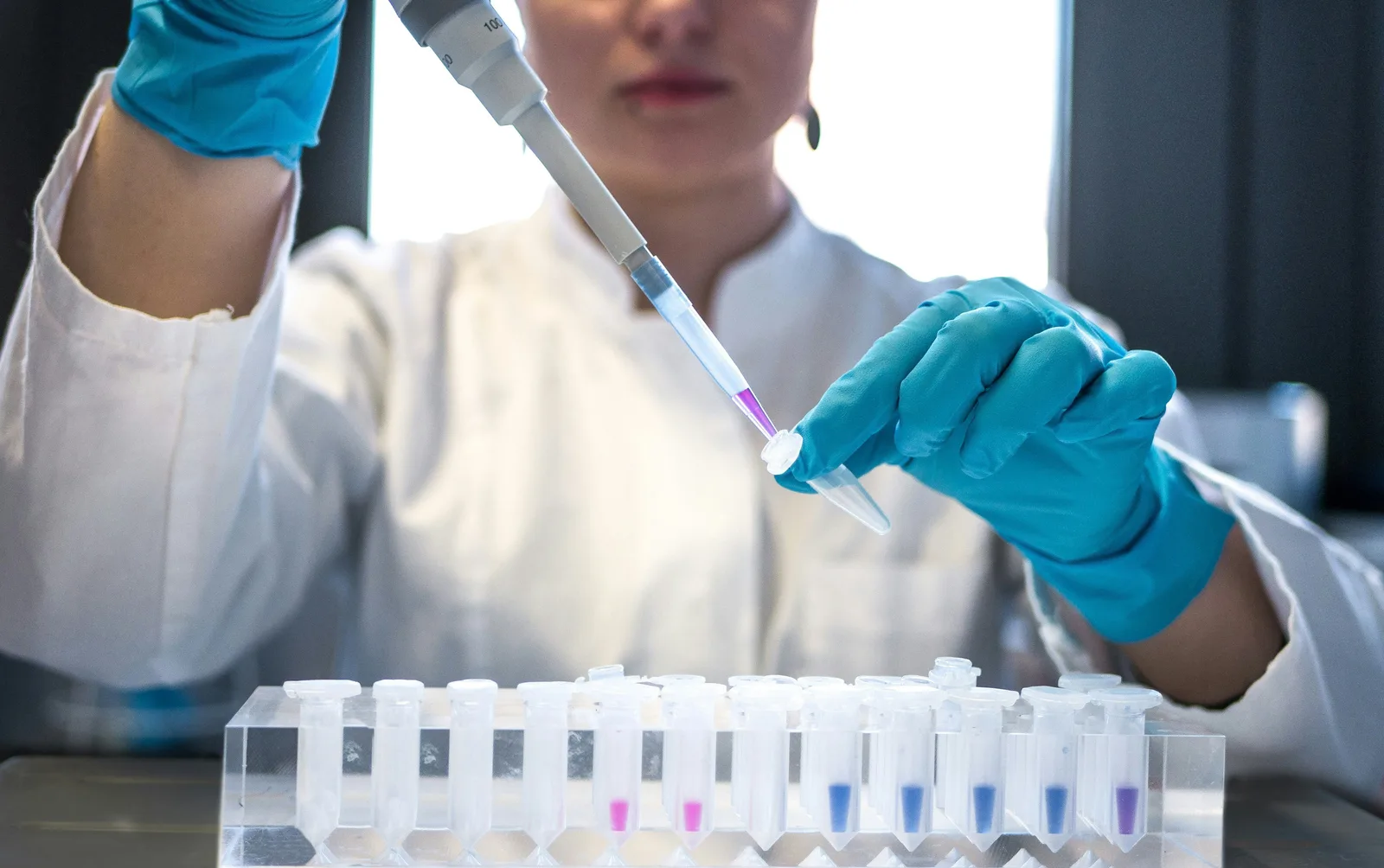 Peste pneumônica pode avançar rápido, mas tem tratamento com antibióticos