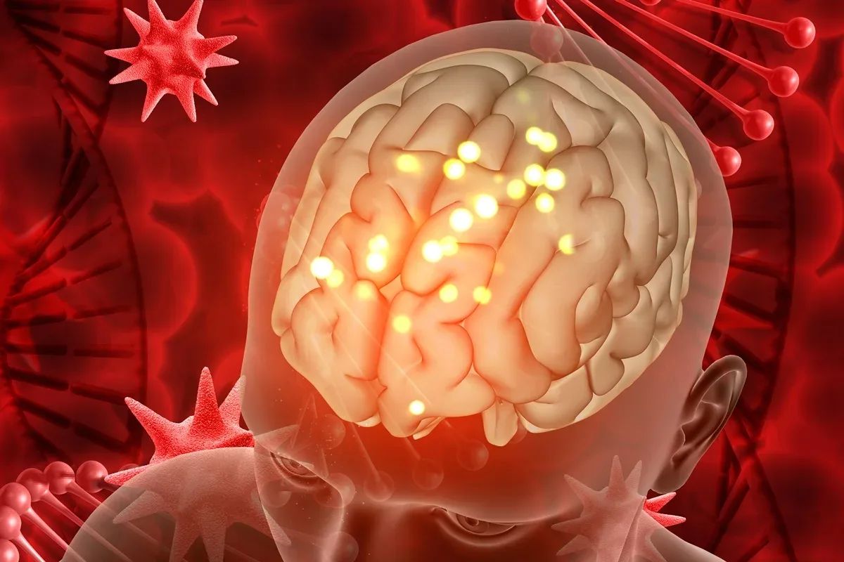Glioblastoma desloca estruturas e altera vasos em experimento com ultrassom