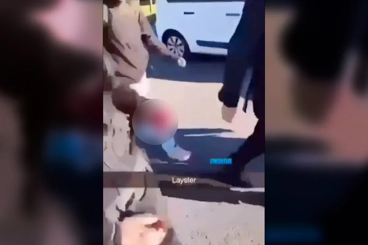 Estudante perde a mão após explosão de granada durante protesto na França