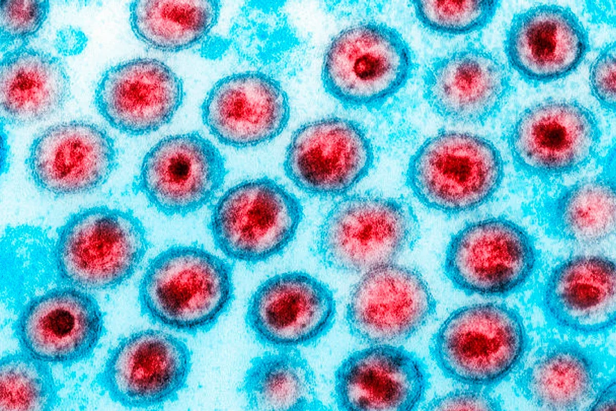 Venetoclax mantém células infectadas pelo HIV em níveis baixos em macacos